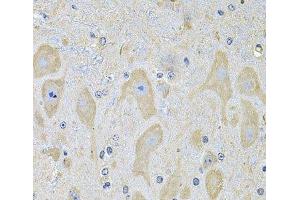 Immunohistochemistry of paraffin-embedded Mouse brain using EPHA2 Polyclonal Antibody at dilution of 1:100 (40x lens). (EPH Receptor A2 antibody)