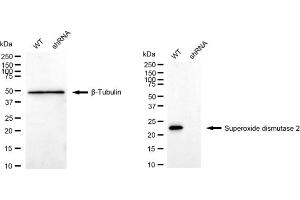 Western blotting analysis using Superoxide dismutase 2 antibody (ABIN7800463). (Recombinant SOD2 antibody)