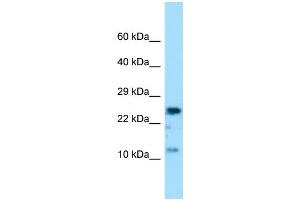 Host: Rabbit Target Name: COX7A2 Sample Type: MCF7 Whole Cell lysates Antibody Dilution: 1. (COX7A2 antibody  (Middle Region))