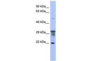Image no. 1 for anti-Phosphomannomutase 1 (PMM1) (N-Term) antibody (ABIN6744071) (PMM1 antibody  (N-Term))