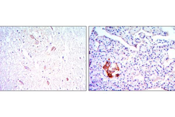KLHL13 antibody
