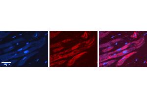 Rabbit Anti-ALAD Antibody   Formalin Fixed Paraffin Embedded Tissue: Human heart Tissue Observed Staining: Cytoplasmic Primary Antibody Concentration: 1:100 Other Working Concentrations: N/A Secondary Antibody: Donkey anti-Rabbit-Cy3 Secondary Antibody Concentration: 1:200 Magnification: 20X Exposure Time: 0. (ALAD antibody  (Middle Region))