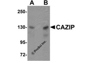 Western Blotting (WB) image for anti-Microtubule-associated Tumor Suppressor Candidate 2 (MTUS2) (C-Term) antibody (ABIN1030322) (CAZIP antibody  (C-Term))