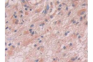 Immunohistochemistry (Paraffin-embedded Sections) (IHC (p)) image for anti-Solute Carrier Family 17 (Acidic Sugar Transporter), Member 5 (SLC17A5) (AA 146-405) antibody (ABIN2907704)