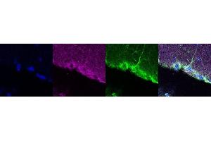 Immunohistochemistry (IHC) image for anti-Coiled-Coil Domain Containing 153 (CCDC153) antibody (ABIN7456016) (CCDC153 antibody)