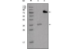 Western Blotting (WB) image for anti-Lipoma-preferred partner (LPP) antibody (ABIN2464077) (LPP antibody)