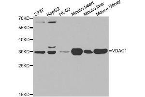 Western blot analysis of extracts of various cell lines, using VDAC1 antibody. (VDAC1 antibody)