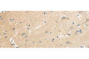 Immunohistochemistry of paraffin-embedded Human brain using SLC7A11 Polyclonal Antibody at dilution of 1/35