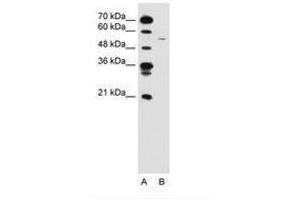 Image no. 1 for anti-Cyclin B1 (CCNB1) (C-Term) antibody (ABIN6736592) (Cyclin B1 antibody  (C-Term))