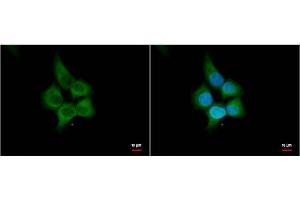ICC/IF Image HHIP antibody [N3C2], Internal antibody detects HHIP protein by immunofluorescent analysis. (HHIP antibody)