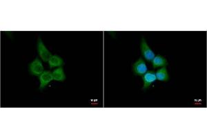 ICC/IF Image HHIP antibody [N3C2], Internal antibody detects HHIP protein by immunofluorescent analysis. (HHIP antibody)
