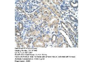 Rabbit Anti-PRPS2 Antibody  Paraffin Embedded Tissue: Human Kidney Cellular Data: Epithelial cells of renal tubule Antibody Concentration: 4. (PRPS2 antibody  (Middle Region))