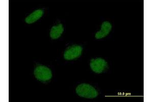 Immunofluorescence of purified MaxPab antibody to RNF113A on HeLa cell. (RNF113A antibody)