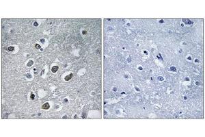 Immunohistochemistry (IHC) image for anti-Membrane-Associated Ring Finger (C3HC4) 4, E3 Ubiquitin Protein Ligase (MARCH4) (C-Term) antibody (ABIN1851268)