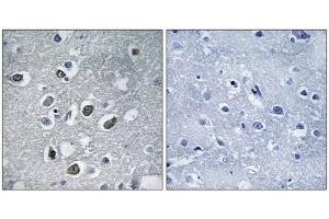 Immunohistochemistry analysis of paraffin-embedded human brain tissue using MARCH4 antibody. (MARCH4 antibody  (C-Term))