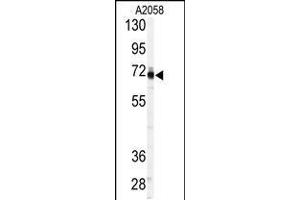Western blot analysis of anti-P in A2058 cell line lysates (35ug/lane). (PAPSS1 antibody  (C-Term))