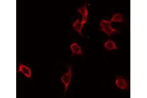 ABIN6276930 staining NIH-3T3 by IF/ICC. (GLB1 antibody  (Internal Region))