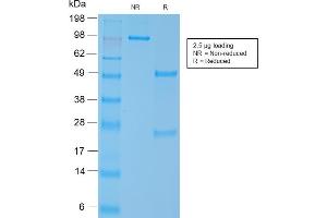 SDS-PAGE Analysis Purified SM-MHC Recombinant Rabbit Monoclonal Antibody (MYH11/2303R). (Recombinant MYH11 antibody)