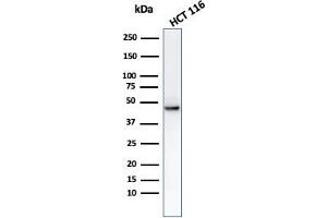 Western Blot analysis of HCT116 cell lysate using using Cytokeratin 8 Mouse Monoclonal Antibody (C-43). (KRT8 antibody)