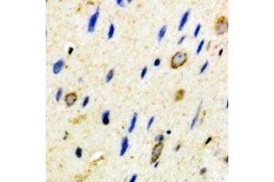 Immunohistochemical analysis of CD59 staining in mouse brain formalin fixed paraffin embedded tissue section. (CD59 antibody)