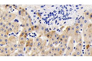 Detection of AIF in Human Liver Tissue using Polyclonal Antibody to Apoptosis Inducing Factor (AIF) (AIF antibody  (AA 103-322))