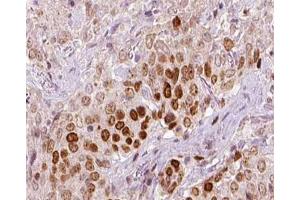 ABIN6266720 at 1/100 staining human liver tissue sections by IHC-P. (REV3L antibody  (N-Term))