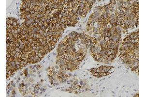 ABIN6277898 at 1/100 staining Human pancreas tissue by IHC-P. (Renin antibody  (Internal Region))