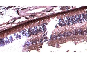 Immunohistochemistry (IHC) image for anti-Arrestin 3, Retinal (X-Arrestin) (ARR3) (C-Term) antibody (ABIN570667)