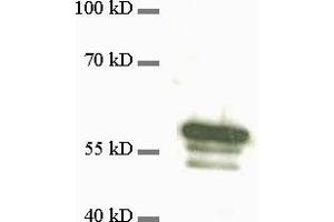 dilution: 1 : 1000, sample: 3T3 cell extract (Vimentin antibody)