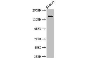Western Blot Positive WB detected in: Rat kidney tissue All lanes: USP6 antibody at 4 μg/mL Secondary Goat polyclonal to rabbit IgG at 1/50000 dilution Predicted band size: 159, 122, 90 kDa Observed band size: 159 kDa (USP6 antibody  (C-Term))