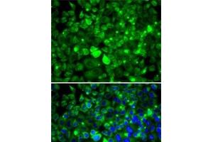 Immunofluorescence analysis of MCF7 cells using RPLP1 Polyclonal Antibody (RPLP1 antibody)