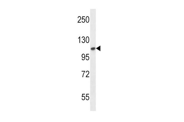 FGFR2 antibody  (N-Term)