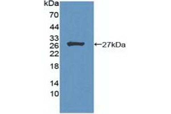 Menin antibody  (AA 219-395)