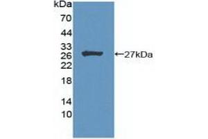 Detection of Recombinant MEN1, Human using Polyclonal Antibody to Menin (MEAI) (Menin antibody  (AA 219-395))