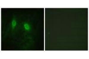 Immunofluorescence analysis of HeLa cells, using IKK-γ (Ab-85) antibody. (IKBKG antibody  (Ser85))