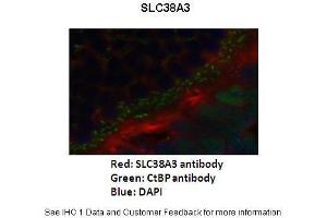 Primary Antibody Dilution :  1:200  Secondary Antibody :   Goat anti-rabbit Alexafluor 568  Secondary Antibody Dilution :  1:200  Color/Signal Descriptions :  SLC38A3: Red CtBp: Green DAPI: Blue  Gene Name :  SLC38A3  Submitted by :  Anonymous (SLC38A3 antibody  (N-Term))