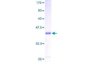 Image no. 1 for D-Dopachrome Tautomerase (DDT) (AA 1-118) protein (GST tag) (ABIN1351304)