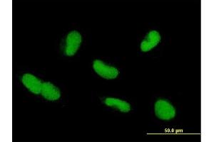 Immunofluorescence of purified MaxPab antibody to ZNF37A on HepG2 cell. (ZNF37A antibody  (AA 1-561))