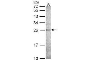 WB Image Sample (30 ug of whole cell lysate) A: A431 , 12% SDS PAGE antibody diluted at 1:1000