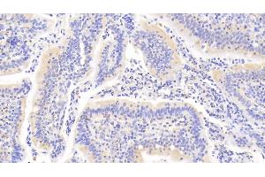 Detection of PTPN22 in Human Small intestine Tissue using Polyclonal Antibody to Protein Tyrosine Phosphatase, Non Receptor Type 22 (PTPN22) (PTPN22 antibody  (AA 1-233))