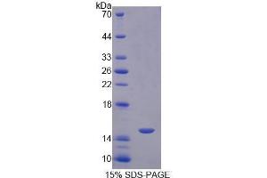 SDS-PAGE (SDS) image for Glycoprotein Hormones, alpha Polypeptide (CGA) (AA 25-120) protein (His tag) (ABIN1079158)