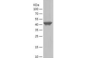 Western Blotting (WB) image for Myosin Heavy Chain 1, Skeletal Muscle, Adult (MYH1) (AA 449-651) protein (His-IF2DI Tag) (ABIN7124057) (MYH1 Protein (AA 449-651) (His-IF2DI Tag))