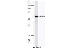 Protein: mouse heart lysate;  Primary: rabbit Anti-SIRT1  at 1: 5000;  Predicted band size: 58/81 kD Observed band size: 58 kD (SIRT1 antibody  (AA 101-200))