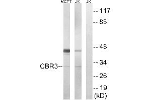 Immunohistochemistry analysis of paraffin-embedded human colon carcinoma tissue, using CBR3 antibody.
