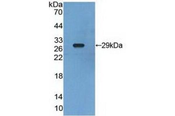 Retinoid X Receptor gamma antibody  (AA 12-220)