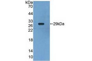 Detection of Recombinant RXRg, Human using Polyclonal Antibody to Retinoid X Receptor Gamma (RXRg) (Retinoid X Receptor gamma antibody  (AA 12-220))