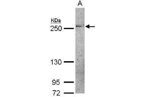 WB Image Sample (30 ug of whole cell lysate) A: IMR32 5% SDS PAGE antibody diluted at 1:500 (THADA antibody  (C-Term))