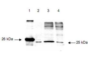 Immunoblot using DIABLO polyclonal antibody  detects a 26 kDa band when 1 ug of recombinant DIABLO is applied (lane 1). (DIABLO antibody  (AA 56-239))