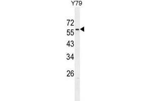 ZNF678 Antibody (C-term) western blot analysis in Y79 cell line lysates (35 µg/lane).