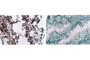 MyoD Immunohistochemistry. (MYOD1 antibody  (Internal Region))